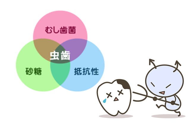 虫歯ができる原因